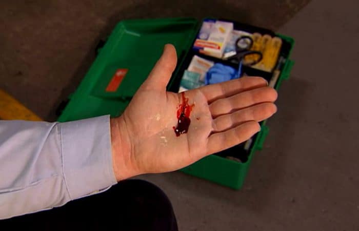 Cuts And Bleeding - First Aid Online Training