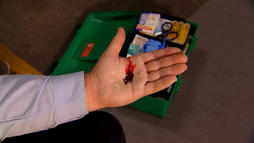 Cuts and Bleeding - First Aid Online Training