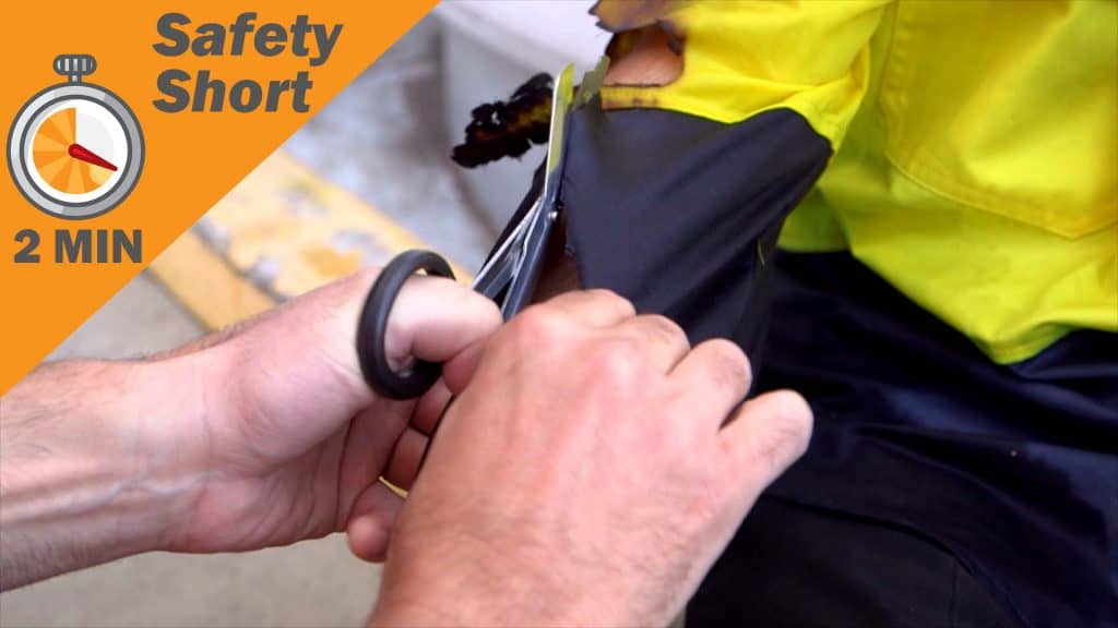 Safety Short - First Aid for Burns